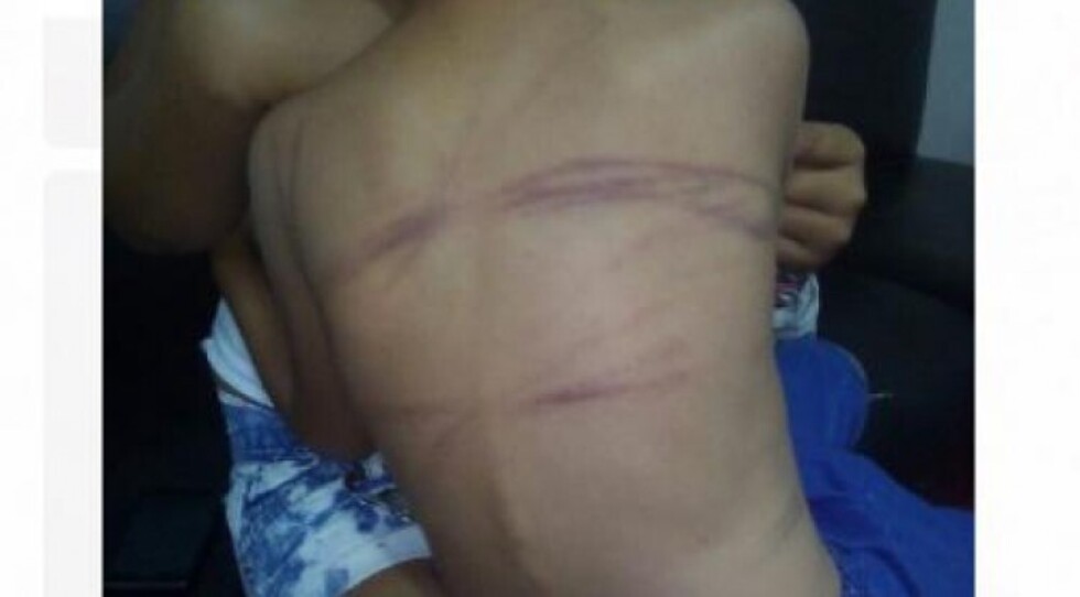 Denuncian a sujeto por golpear a hijo con cable