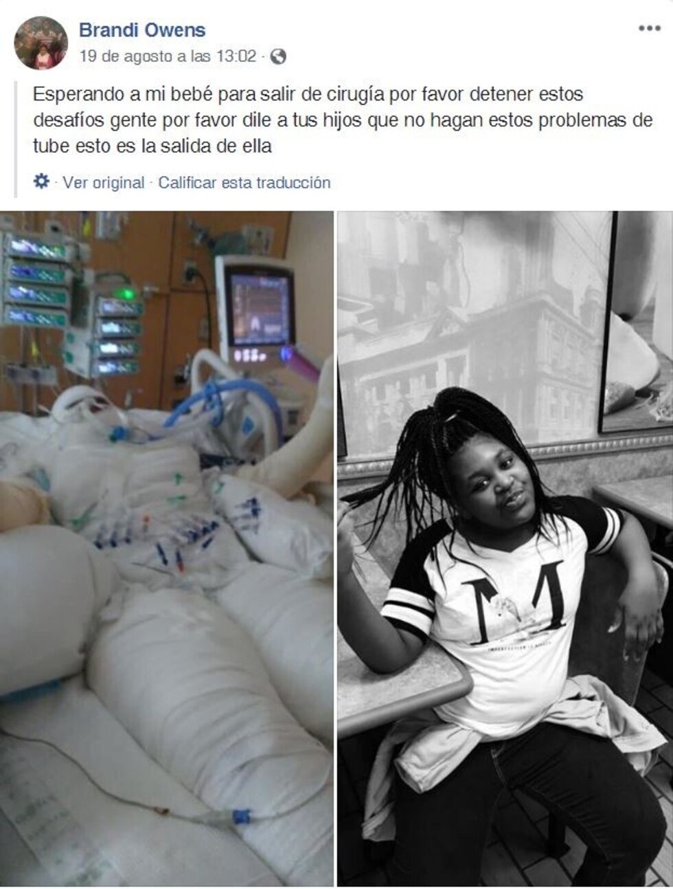 "Ardió desde las rodillas hasta el pelo": Niña de 12 años sufre graves quemaduras en un reto viral