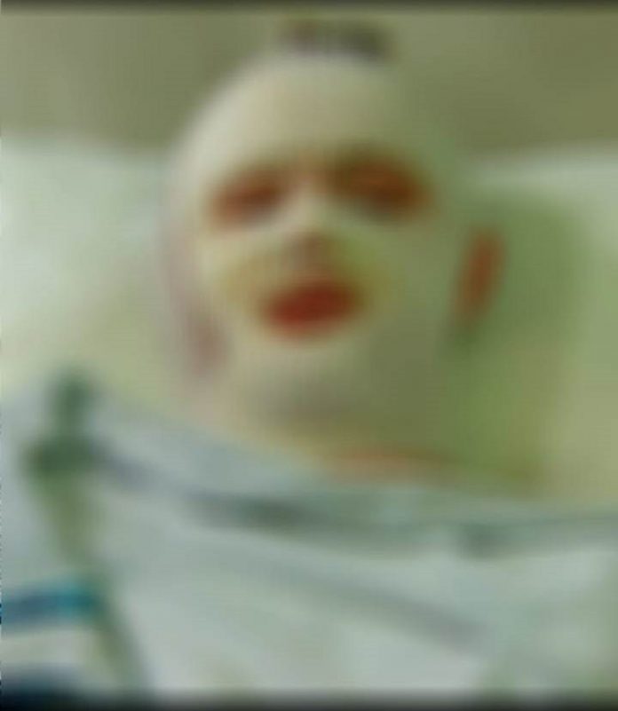 Perro desfiguró el rostro de un joven en Bermejo