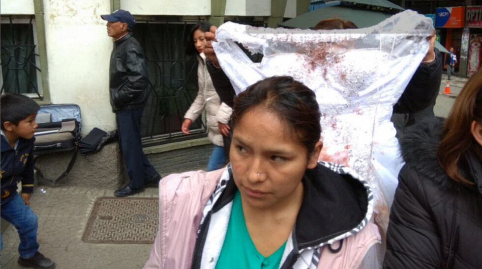 Piden cárcel para novio que golpeó a su pareja