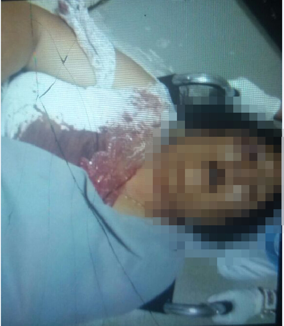 Golpeó a concubina con fierro y una llave en el afán de matarla