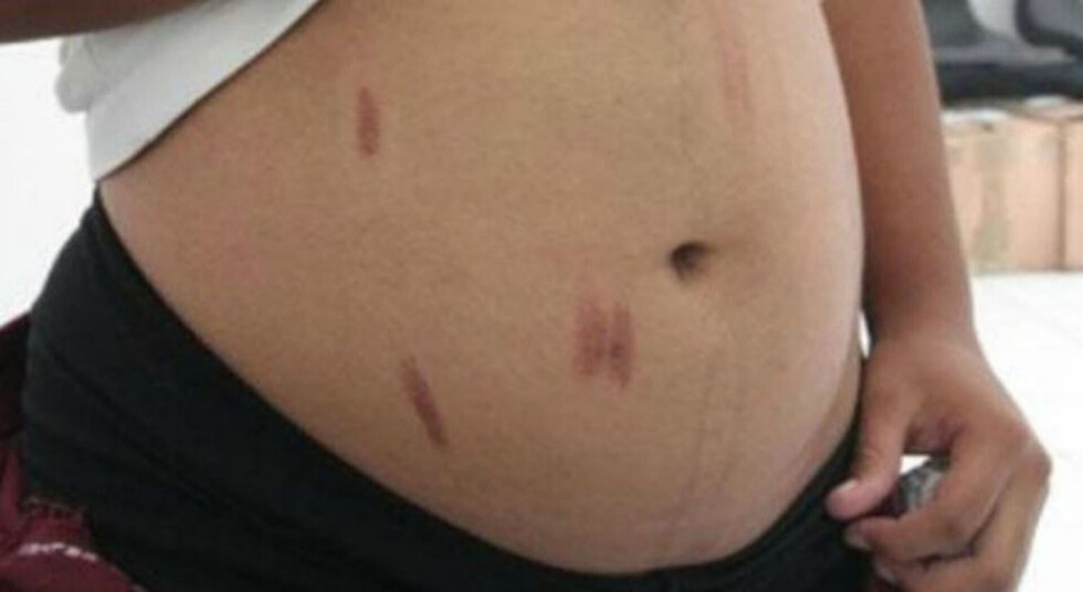 Golpeó a su concubina  embarazada y lo apresaron