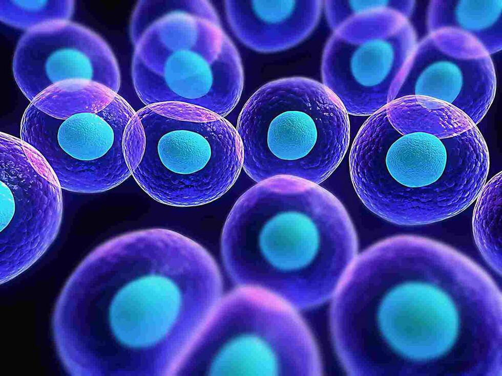 ¿Qué son  las células  madre?