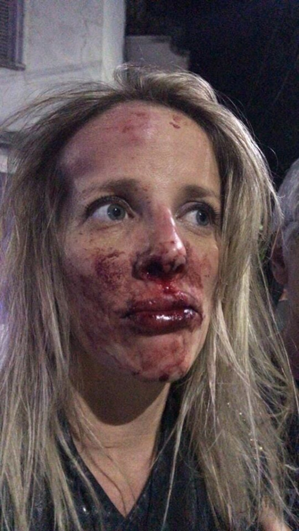 Médica fue desfigurada en la calle por un desconocido