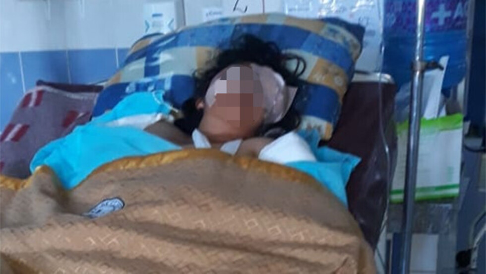 Víctima de violencia está por perder la vista de un ojo