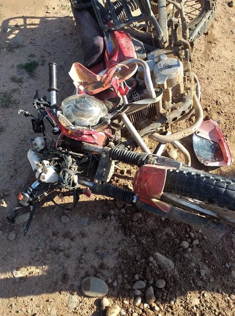 Embisten a una embarazada y pierde al bebé
