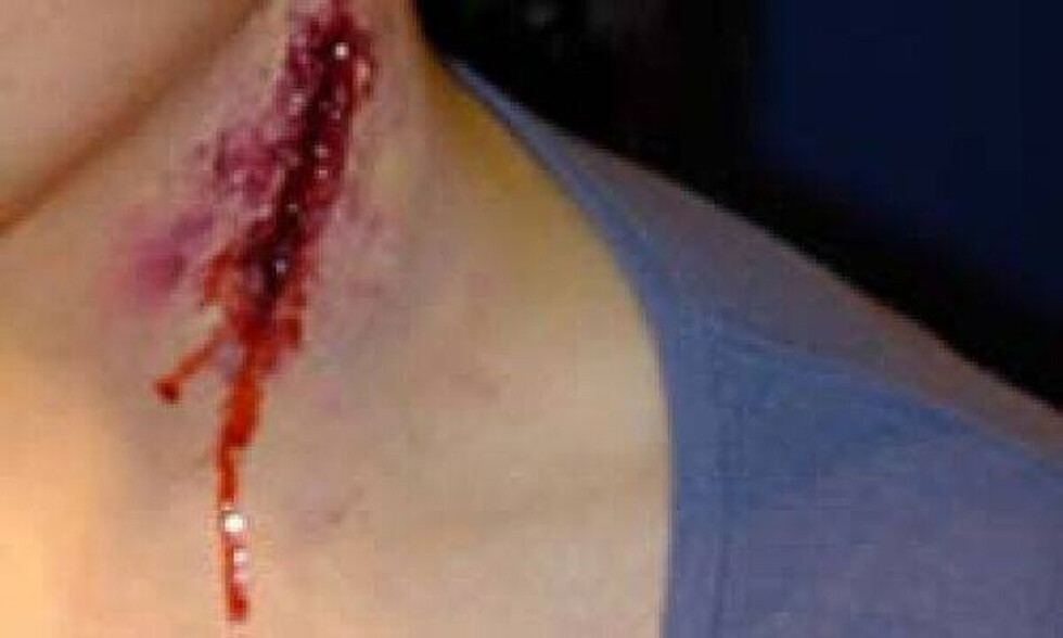 Joven cortó el cuello al concubino de su madre