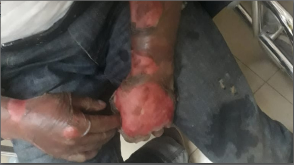 Al penal mujer acusada de quemar a su esposo