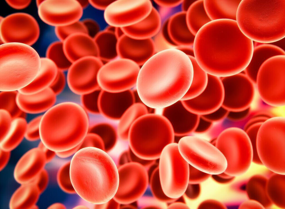 Las causas  de la anemia