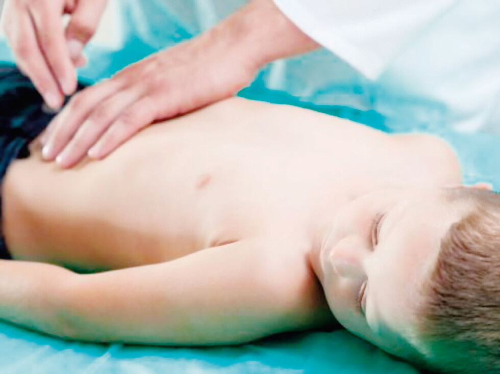 Apendicitis en los niños