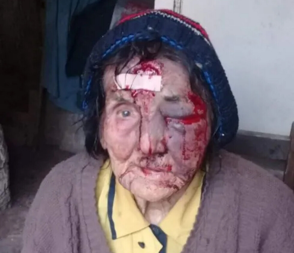 Golpearon a una anciana por robarle su tv y una garrafa