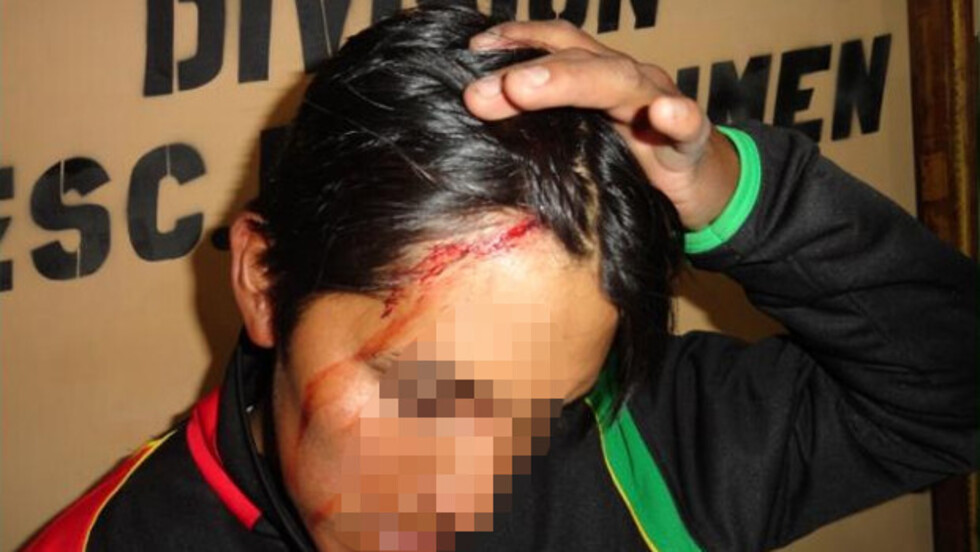 Hieren a policía con destornillador en El Alto