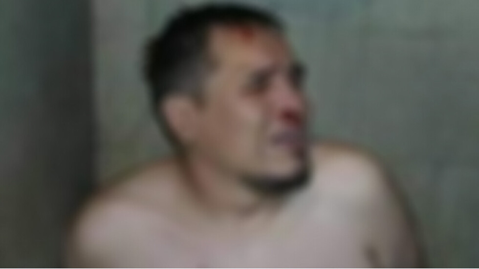 Régimen cree que Jhasmani planeó autotortura