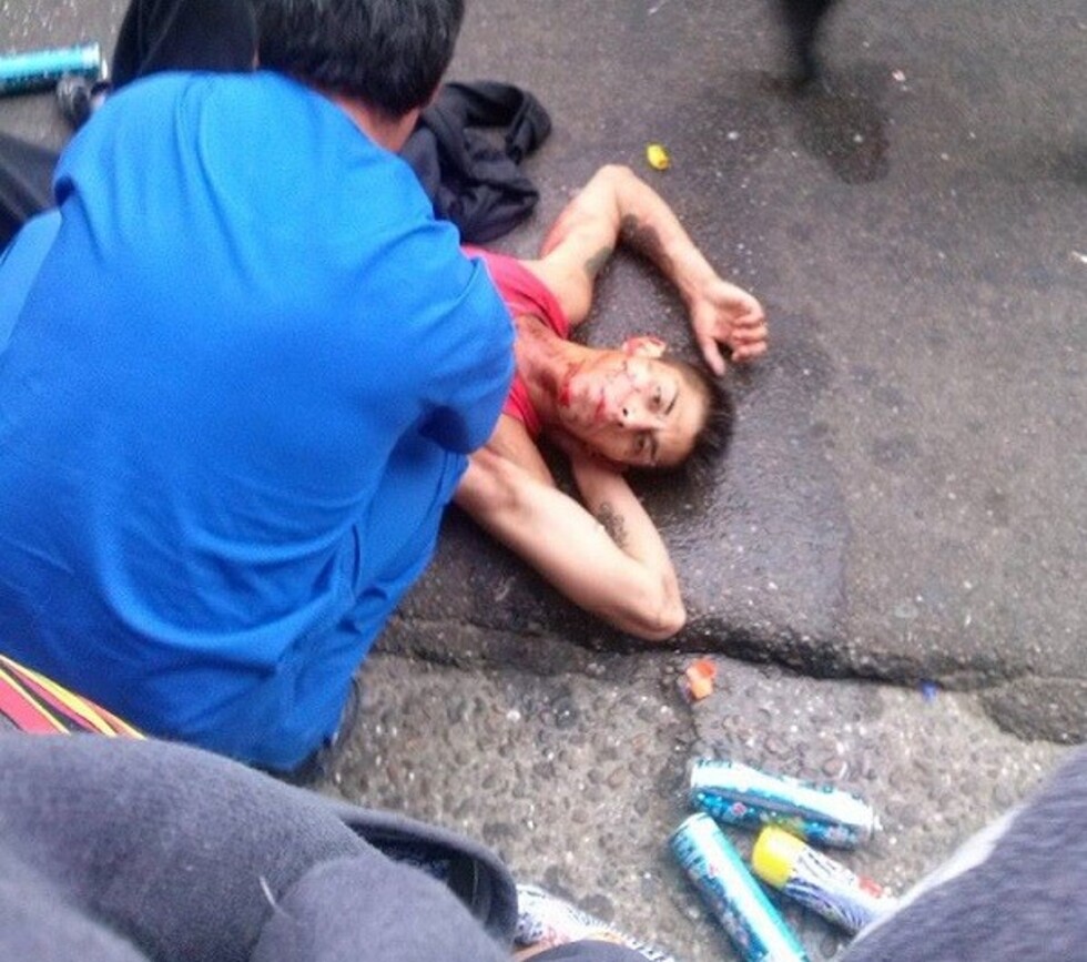 Roban  y apuñalan a un adolescente de 17 años
