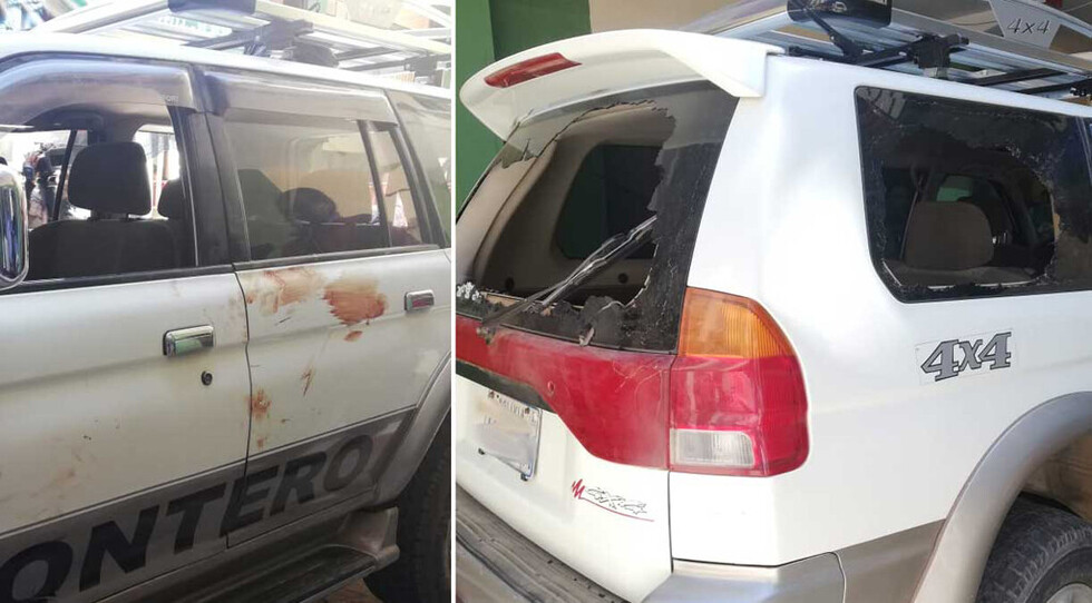 Intentó escapar de  la Aduana y lo hirieron