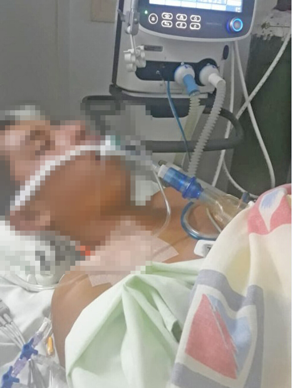 Motociclista en terapia intensiva tras una colisión