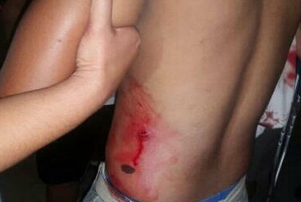 Sujeto fue disparado por su amigo en su propia casa en Yacuiba