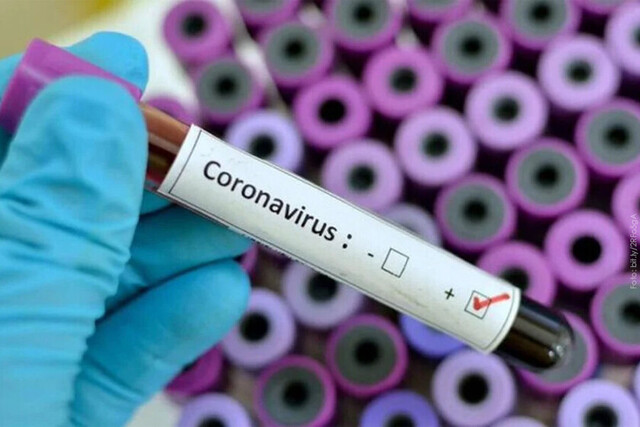 El Sedes Tarija prepara plan contra el coronavirus