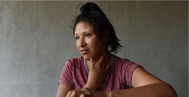 Tres mujeres y un hombre desfiguraron a una joven en Tucumán