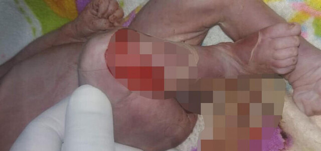Borrachos hacen de parteros y matan a bebé en una chichería