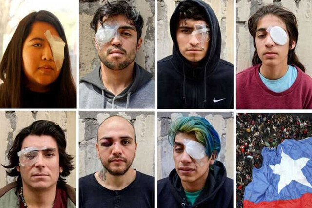 Sube a 445 los heridos con lesiones oculares en Chile