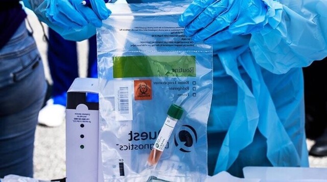 Bolivia: Llegarán 20.000 pruebas para Covid-19 la próxima semana
