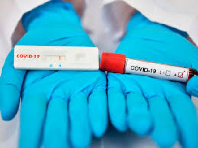 Covid-19: Sedes cobrará Bs 700 a Cajas y Clínicas por las pruebas PCR