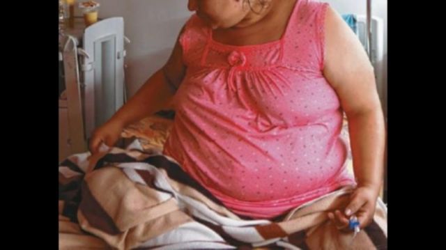 Advierten que 92% de los pacientes en terapia intensiva en Tarija tienen obesidad