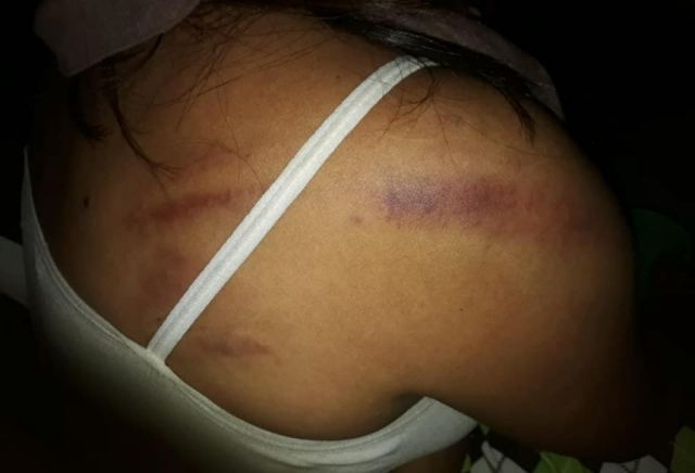 Sentencian a sujeto por tentativa de feminicidio 