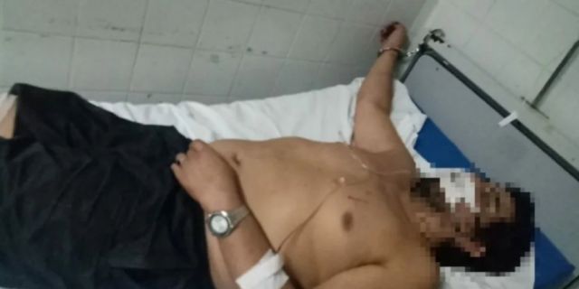 Policías balearon a hombre que quiso matar a su pareja