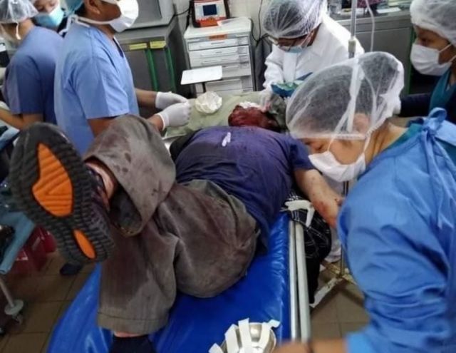Chofer pierde una mano por explosión de dinamita