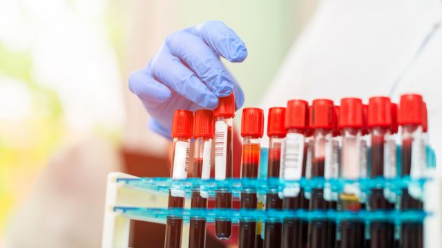 Crean el primer test de sangre que identifica simultáneamente si un paciente tiene cáncer y si se ha propagado