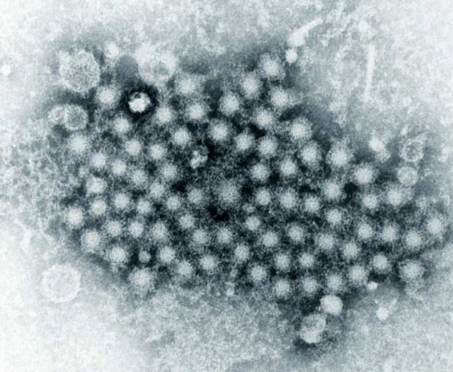 Descubren que una enzima del champiñón es eficaz contra la hepatitis C