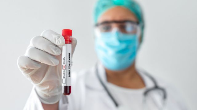 OMS registra 1.000 casos de viruela del mono y anuncia que ya hay transmisión comunitaria