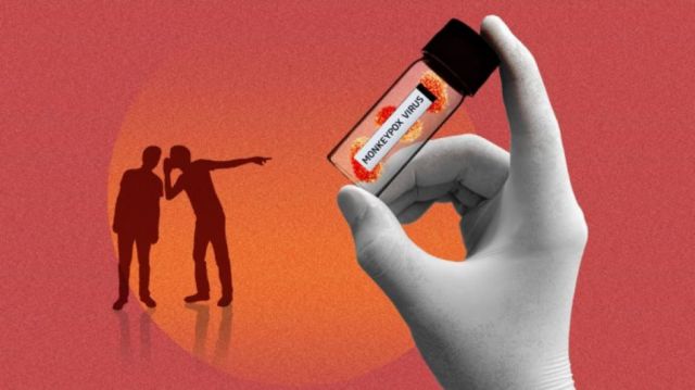 Viruela símica: un virus con estigma y exceso de alarma