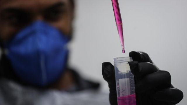 En 2021 el VIH mató a 650.000 personas, un 15% menores