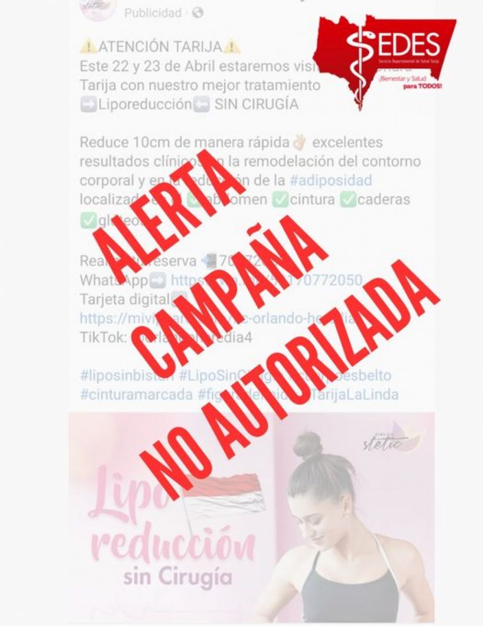 Sedes alerta sobre campaña de lipoescultura ilegal en Tarija