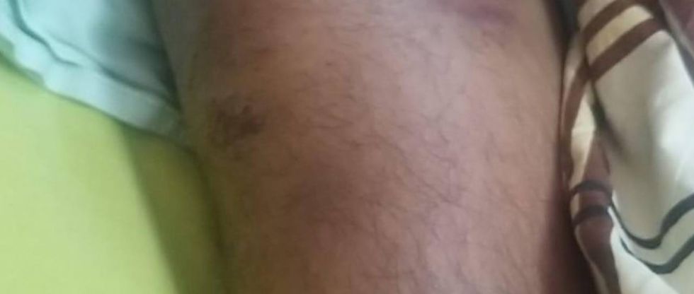 Militar de Villa Montes aprehendido por supuesto acoso fue “torturado” y ahora lucha por su vida en un hospital, denuncia su familia
