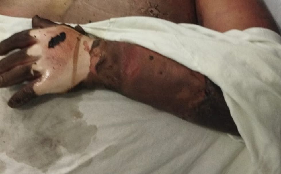Encarcelan a hombre que intentó quemar al supuesto amante de su esposa 