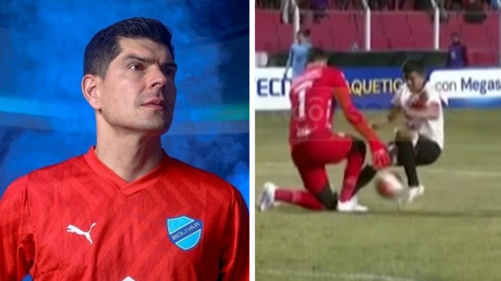 Lampe mostró marcas de toperoles y con ironía posteó: “Tranquilo que no hubo plancha”