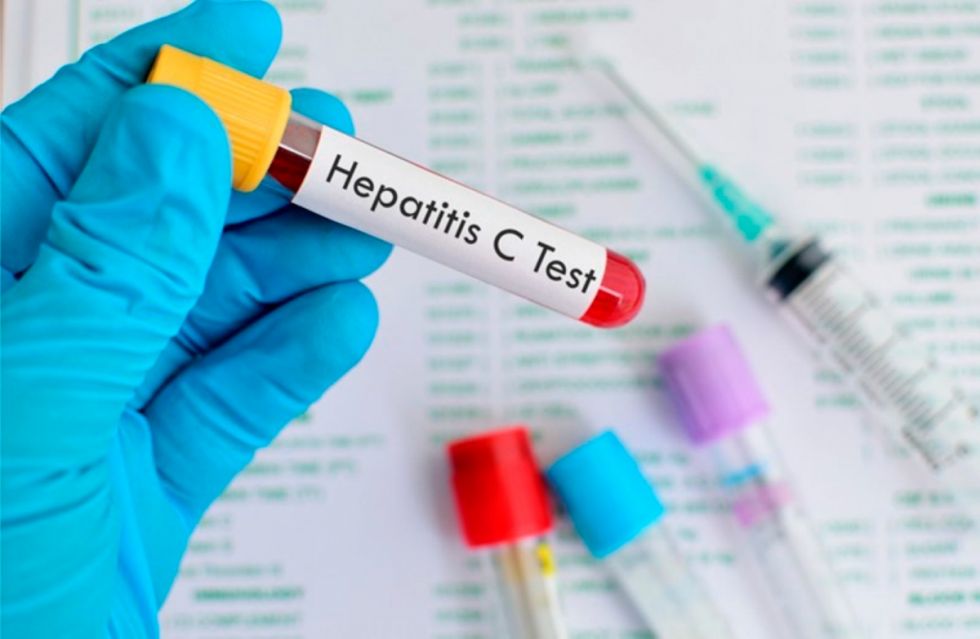 Tarija: Reportan casos de hepatitis en 4 municipios 
