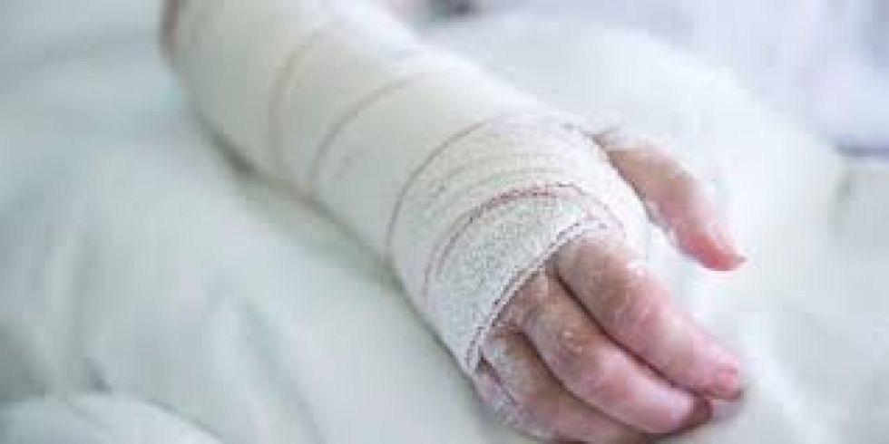 Una mujer le quemó las manos a su hija de 8 años por alzar Bs 4 sin permiso