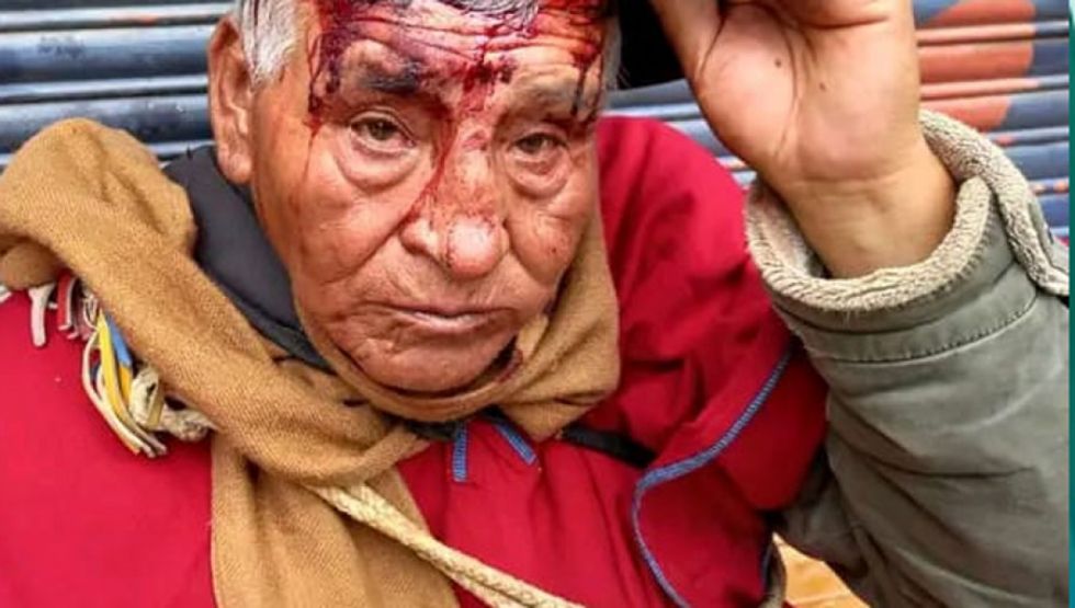 Defensor lamenta represión policial y uso indiscriminado de gases en enfrentamiento con los campesinos