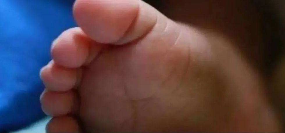 Beni reporta su primer caso de sarampión, se trata de una niña procedente de Santa Cruz