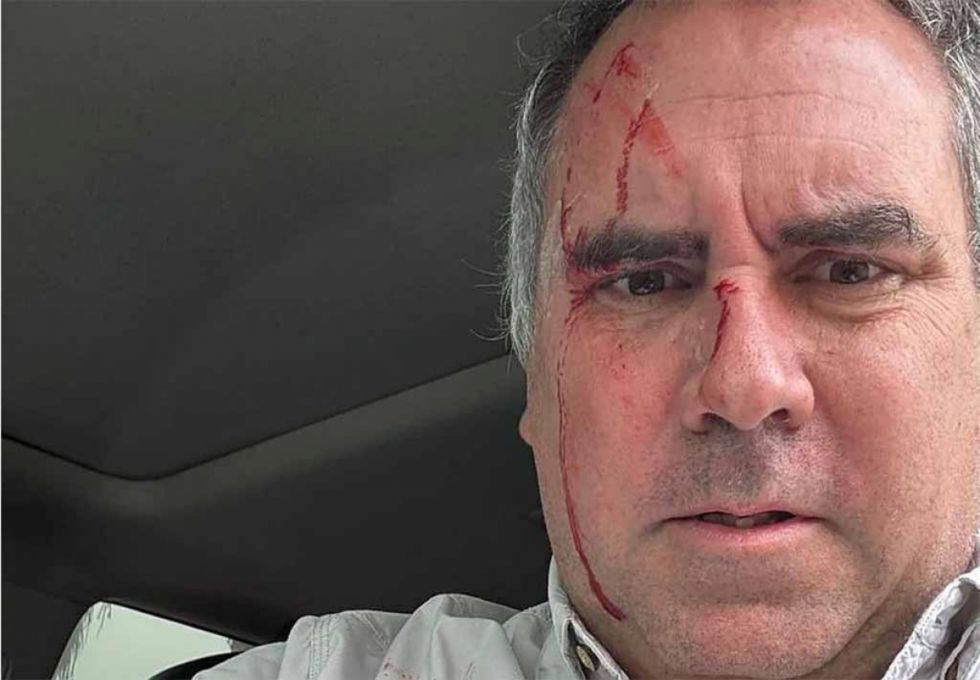 Atacan a balazos a candidato de Perú