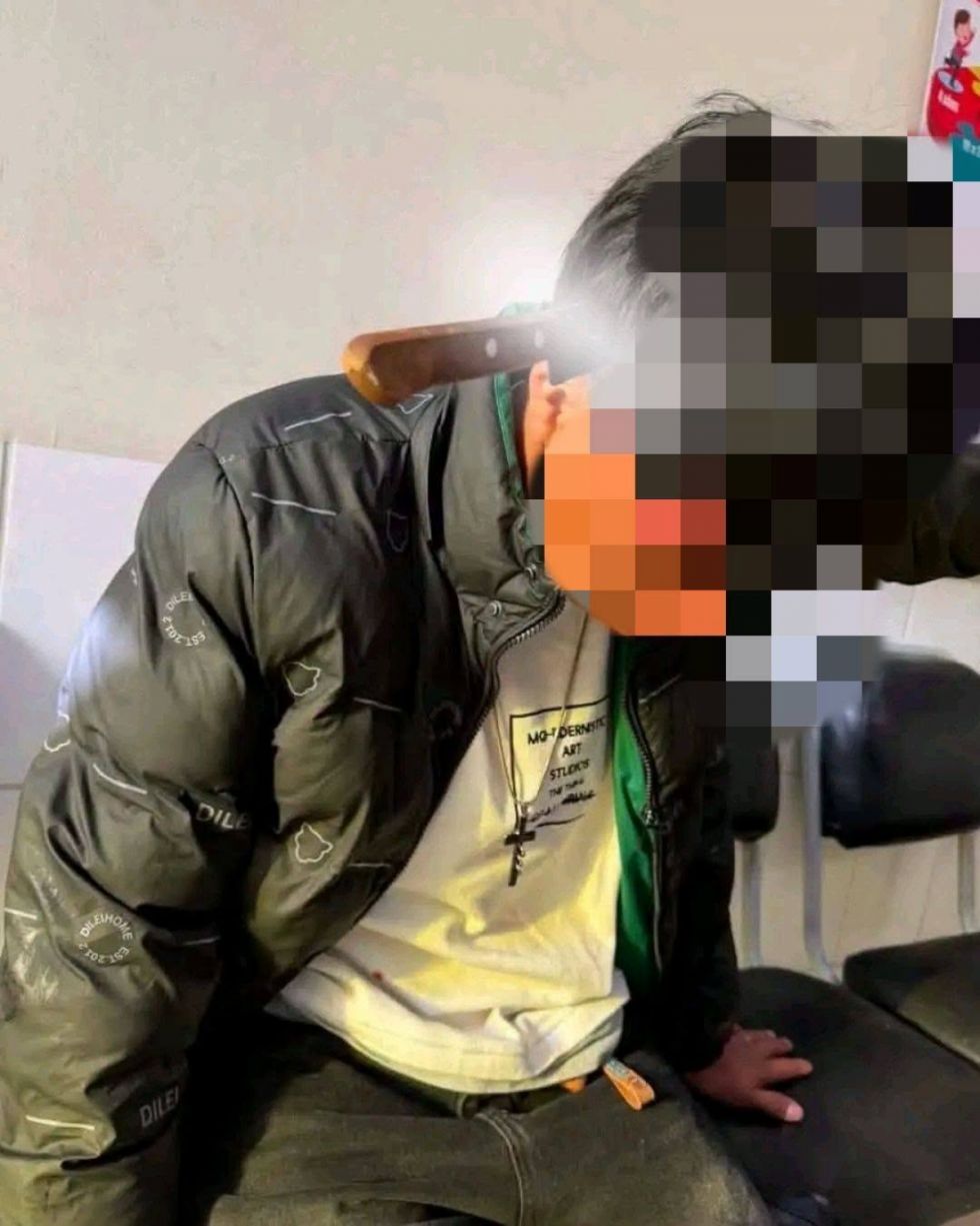 Joven es hallado corriendo con un cuchillo incrustado en la cabeza en La Paz